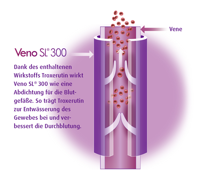 Wirkung von Veno SL® 300 anhand einer Illustration